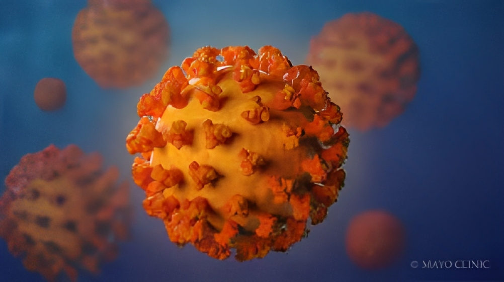What Causes a Coronavirus?
