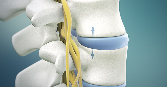 What is lumbar herniated disc icd 10